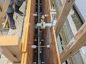 アンカーセット